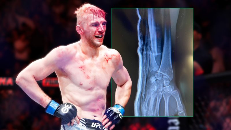 ‘Just a scratch’: Kiwi UFC weapon Dan Hooker breaks wrist in middle of hectic UFC 290 fight